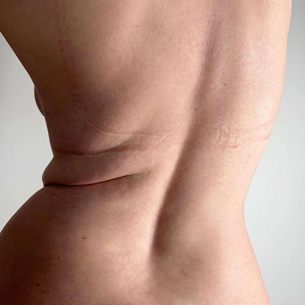 Top-Rated Why A 5-Pound Weight Gain Isn’T The End Of The World